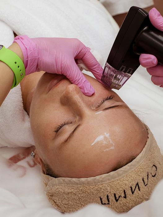 Morpheus 8 Needle RF lifting procedure in Moscow