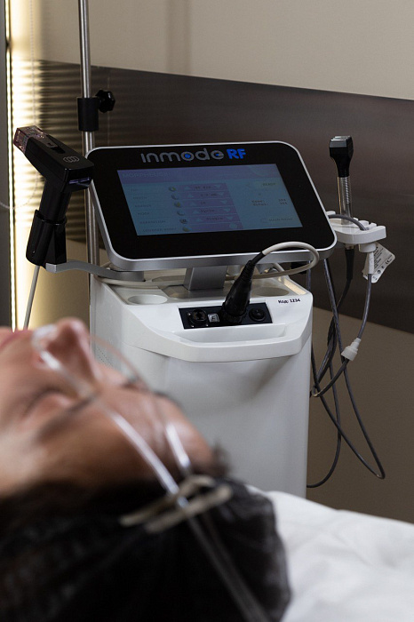 Consultation before Morpheus 8 needle RF lifting