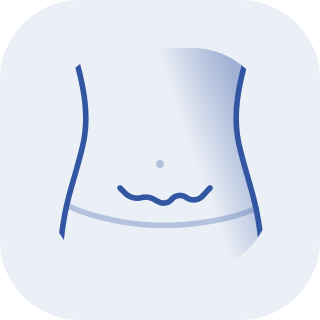  Кожно-жировой фартук в нижней части живота